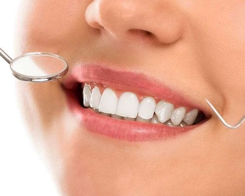 Estética dental